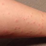 ドクダミの葉は 皮膚炎を和らげます ドクダミはすごかった 皮膚の万能薬です 生活の知恵袋