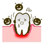 歯周病の症状と予防方法について　おすすめの予防方法を紹介します